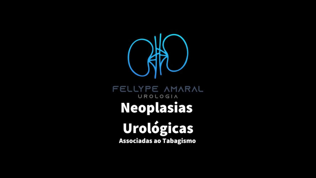 Neoplasias Urológicas Associadas ao Tabagismo